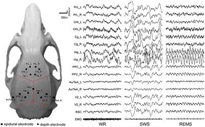 Reentrant Information Flow in Electrophysiological Rat Default Mode Network